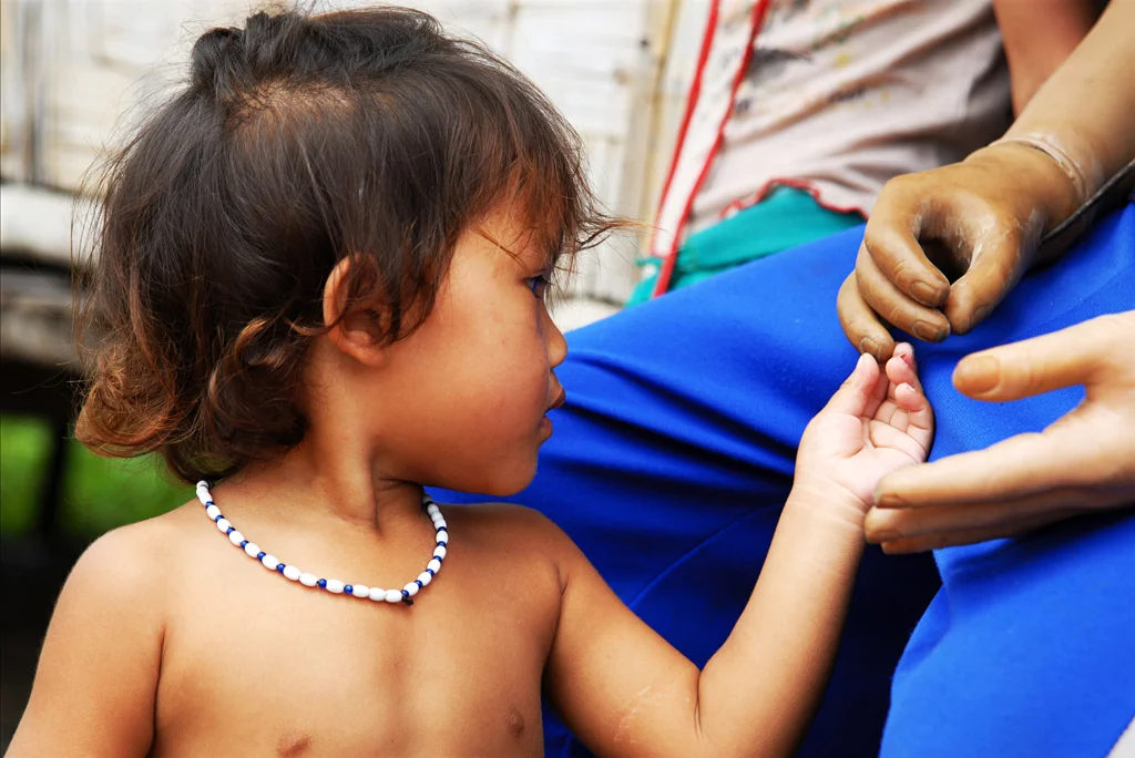 Ta’s child fondly caresses the prosthetic of her father who lost both his arms and his right eye when he attempted to open a cluster muntion to remove the explosives for fishing. Ta received his prosthetic arms from COPE - a local project who supports the government run service in providing rehabilitation services and mobility devices free of charge to those who cannot afford to pay. Kammoune Province, Laos. 
