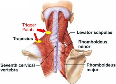 How Massage Can Help Alleviate Knots & Pain in the Neck & Shoulder Area