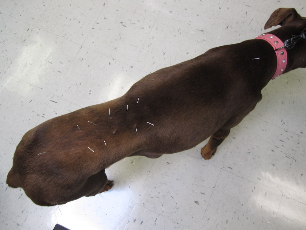 A patient rests during an acupuncture treatment. 