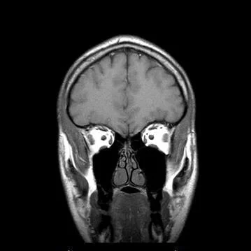 Alan Ens [self-titled]