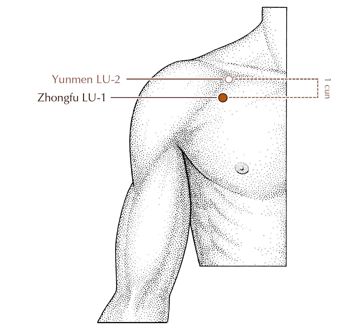 Diagram showing the location of acupuncture point Lung-1 below the collarbone