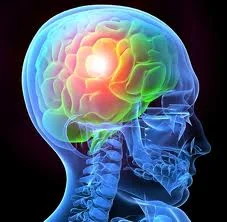 Traumatic Brain Injury.jpeg