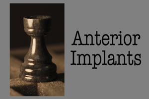 AnteriorImplants.sm.jpg