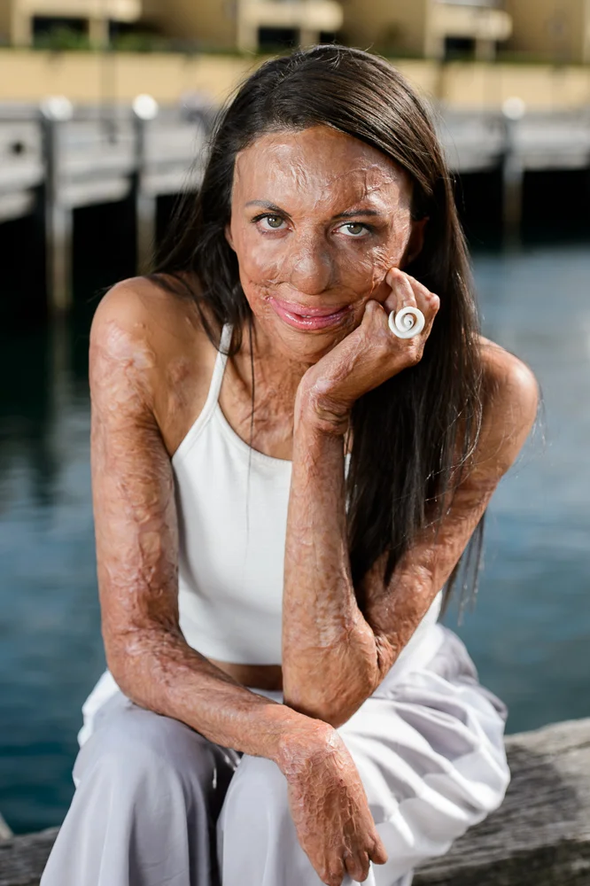Turia Pitt
