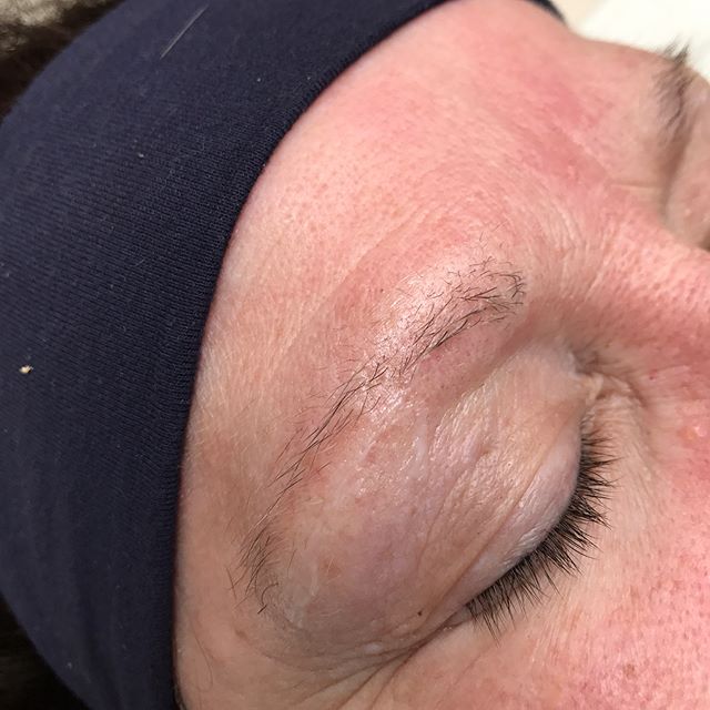 Debating on starting a feed solely for microblading...🤔...but wanted to share my mom's brow transformation! 
First photo is my mom's natural brows prior to microblading. Like most more mature women, she spent most of her life over-plucking, which le