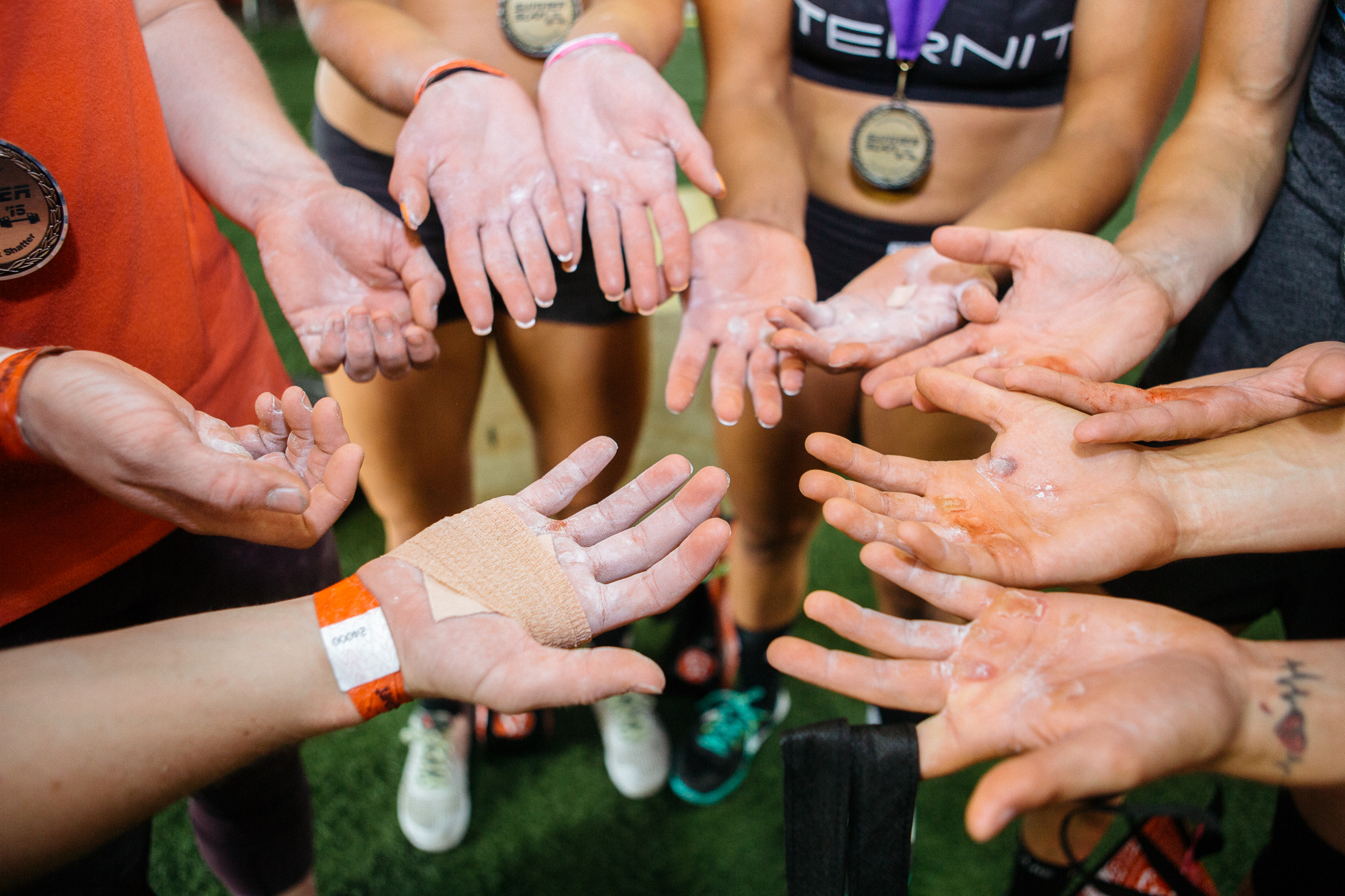 These are the hands of the RX ladies after the final event. So tough.