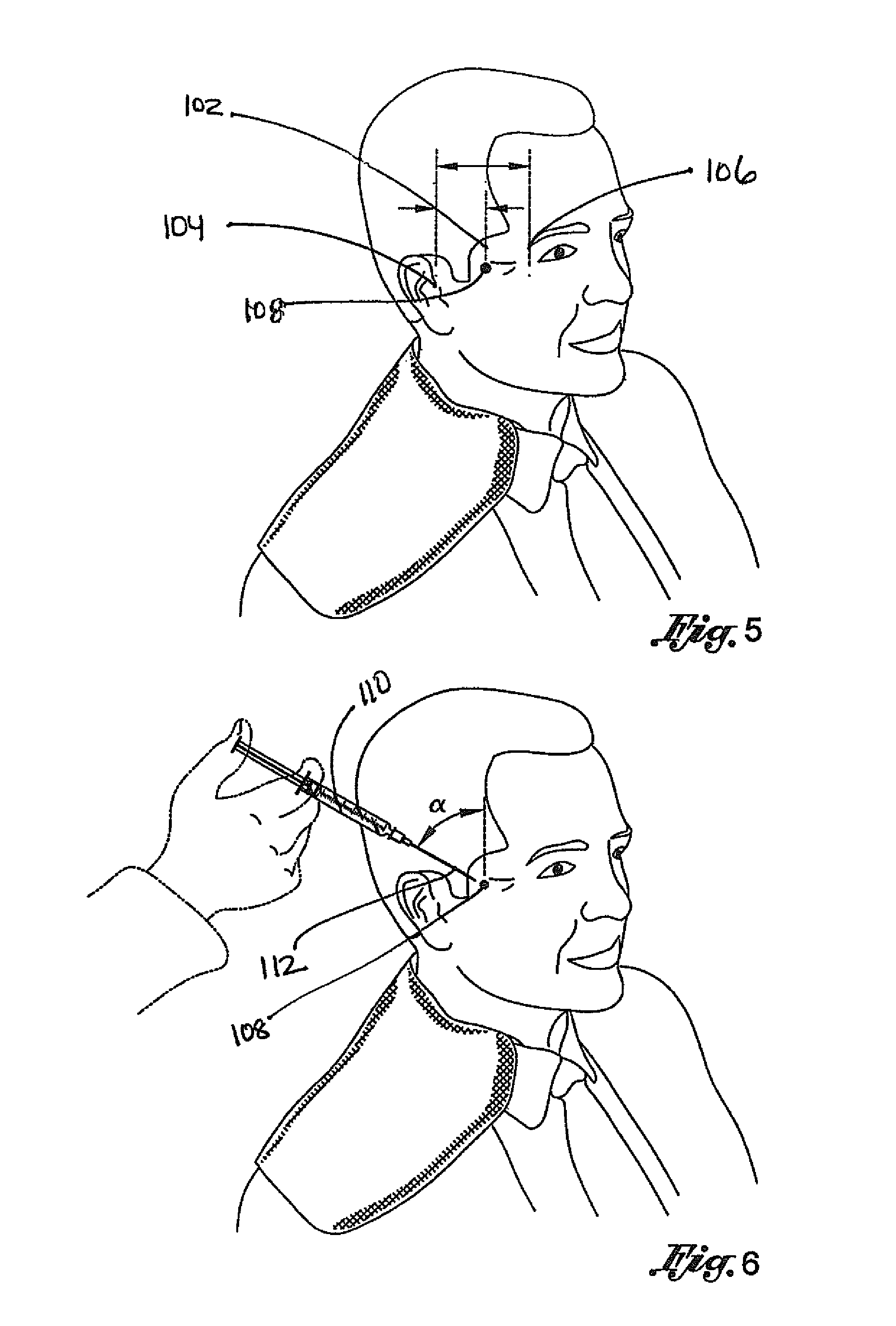 ภาพจาก https://patentimages.storage.googleapis.com/US8530425B2/US08530425-20130910-D00005.png