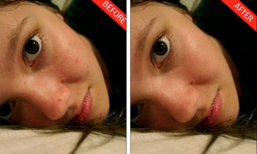 The UK's Daily Mail puts Aviary's Blemish Tool through its paces. 