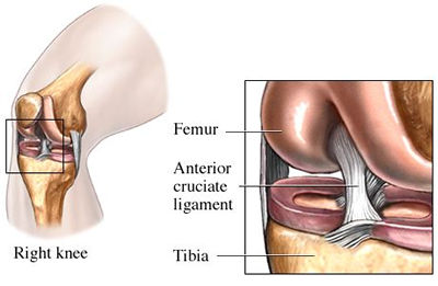 The ACL helps you cut, plant, and pivot without exploding your knee.