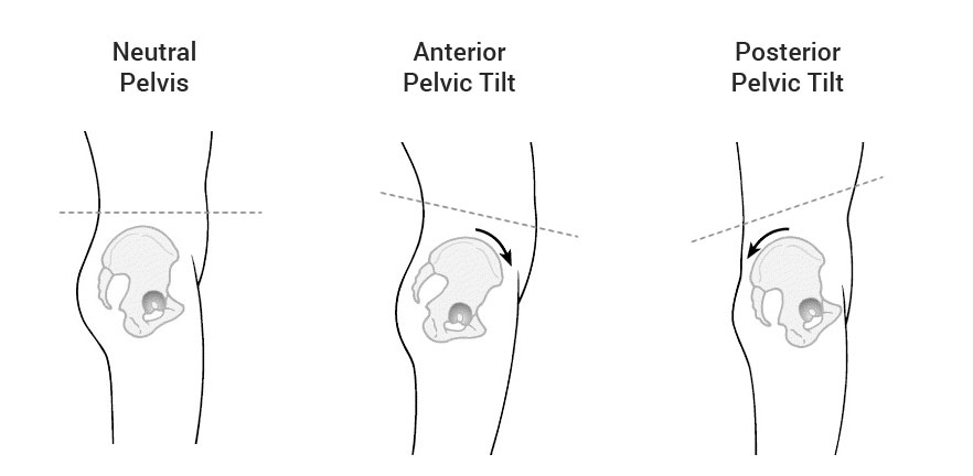 Anterior pelvic tilt may indicate a tight, short psoas. Posterior pelvic tilt may indicate an overstretched psoas. What does your pelvis indicate?