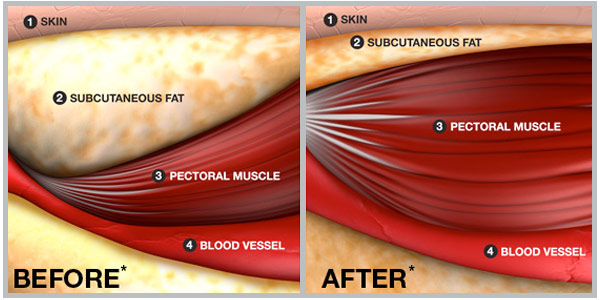 Illustration of increased muscle mass and decreased fat mass after adopting a strength training regimen.