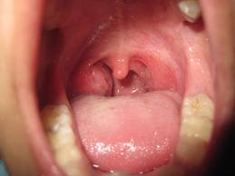 The Upside of (Elective!) Surgery