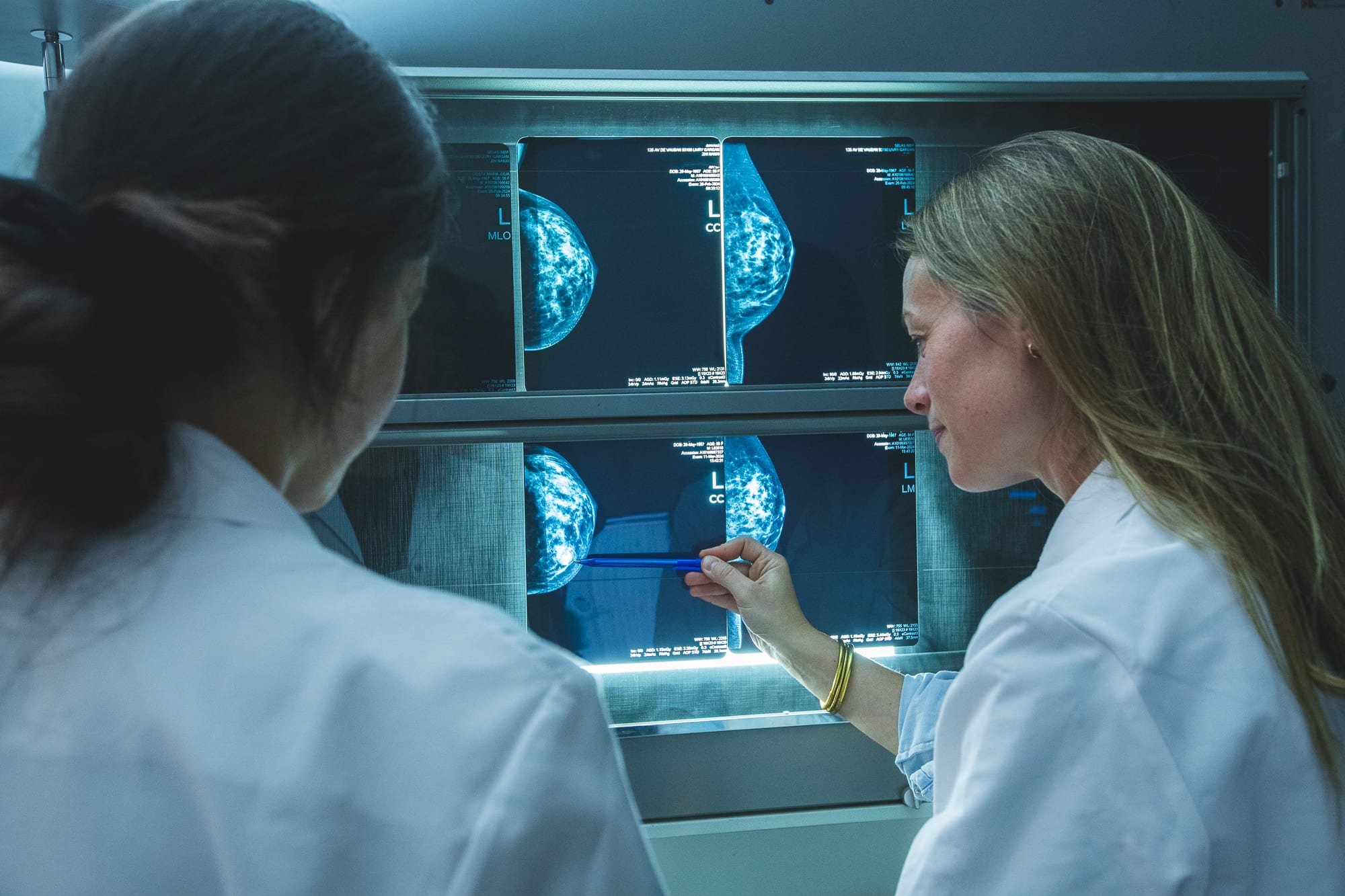 Reportage photo médical, analyse de mammographies par une équipe médicale en centre de radiologie.