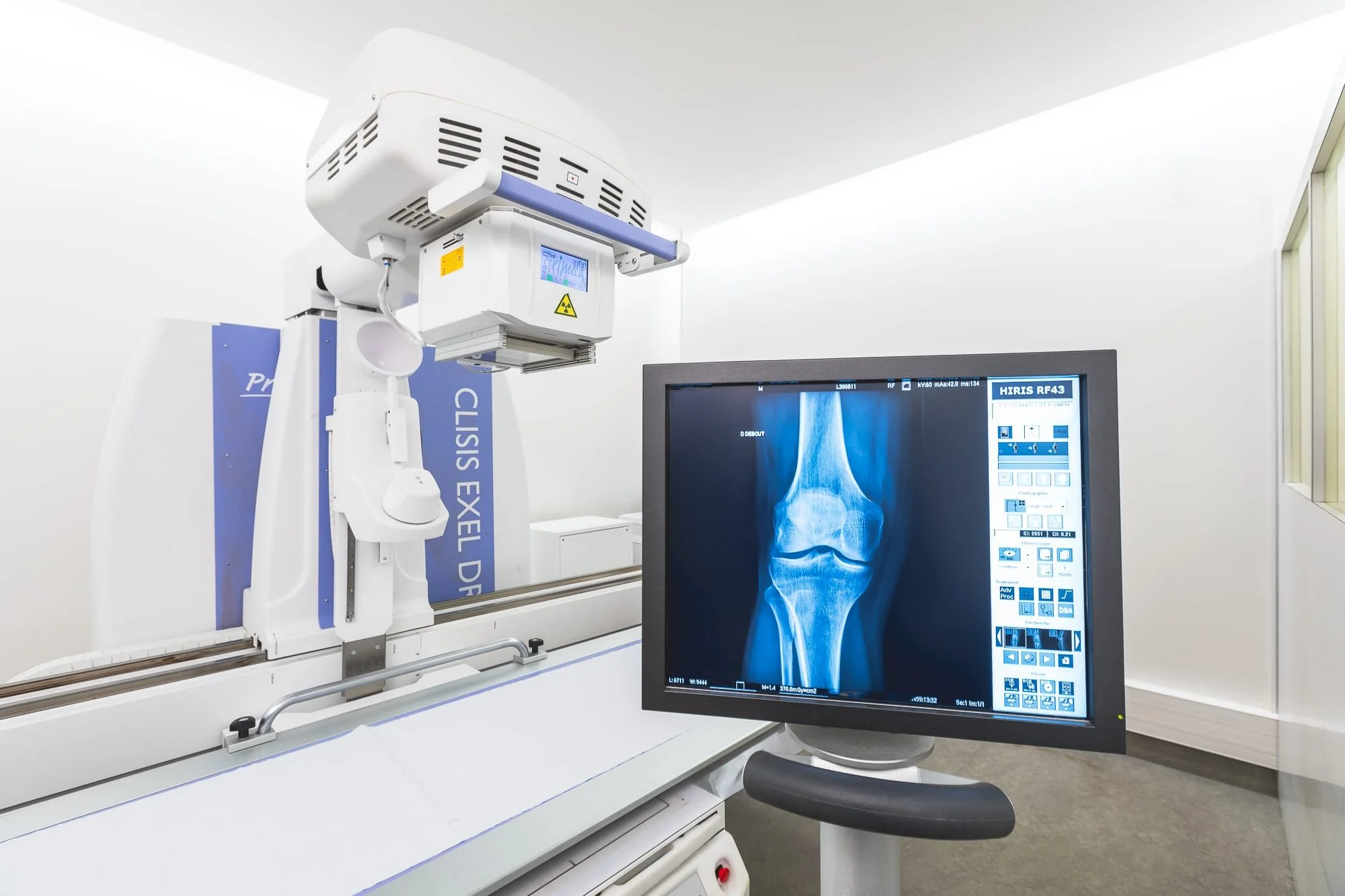 Reportage photo médical, salle de radiologie avec équipement d’imagerie médicale et écran de diagnostic.