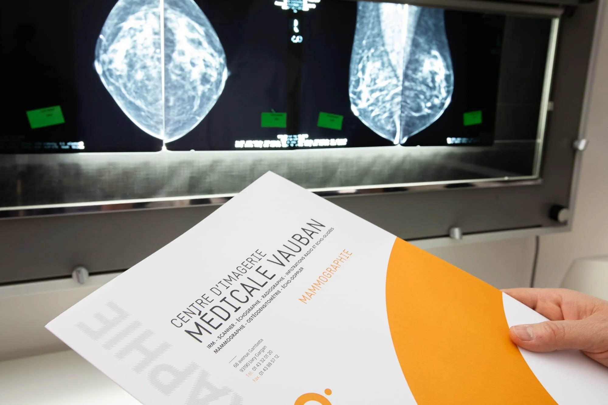 Reportage photo médical, dossier patient et images de mammographie dans un centre d’imagerie médicale.