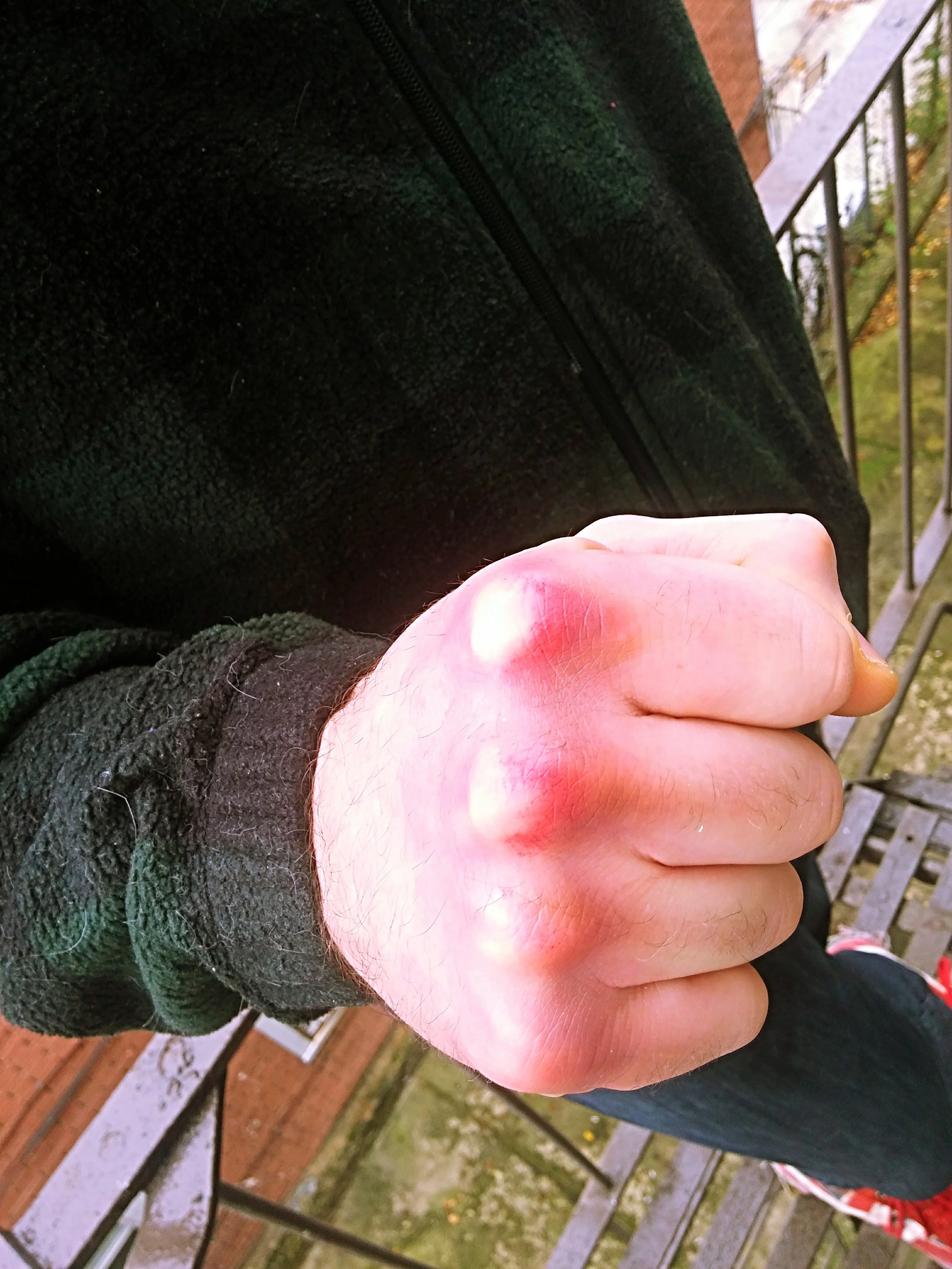 IMG_20151119_131307.jpg