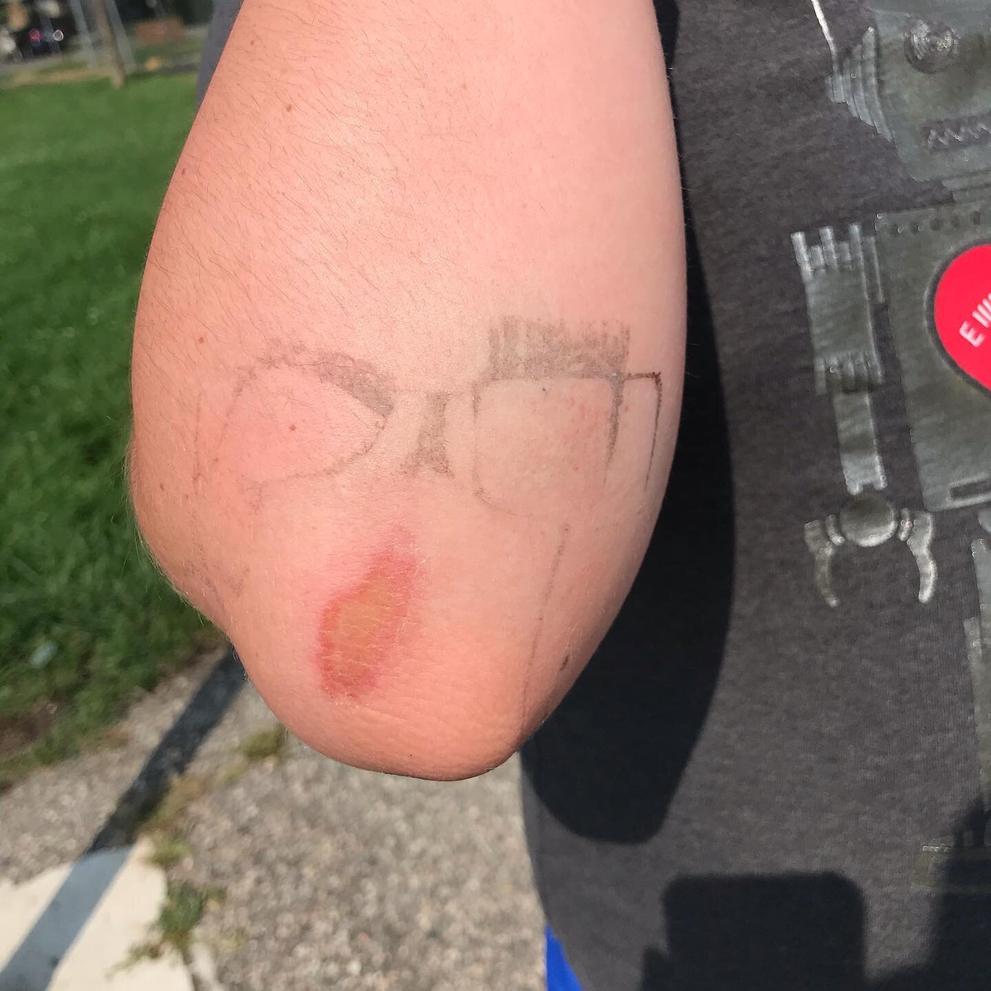A scrape and some residual tape marks on my sons&rsquo; elbow. They are just screaming for attention. Ha!

#boise #idaho #halfbasquejob #skateboard #scrape #scrapeandtape #skater #minorinjuries #kidtattoo