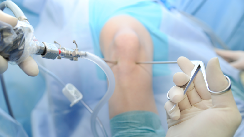 Arthroskopische Knieoperation