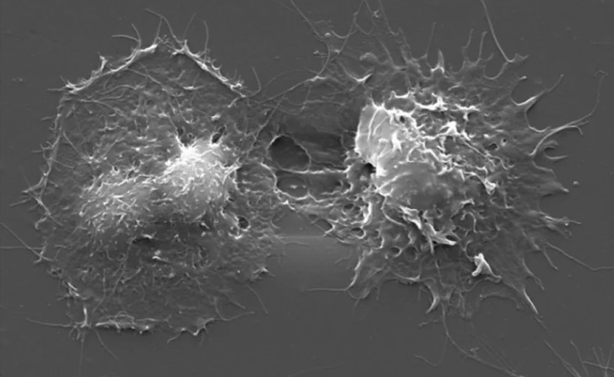 Megakaryocyte spreading