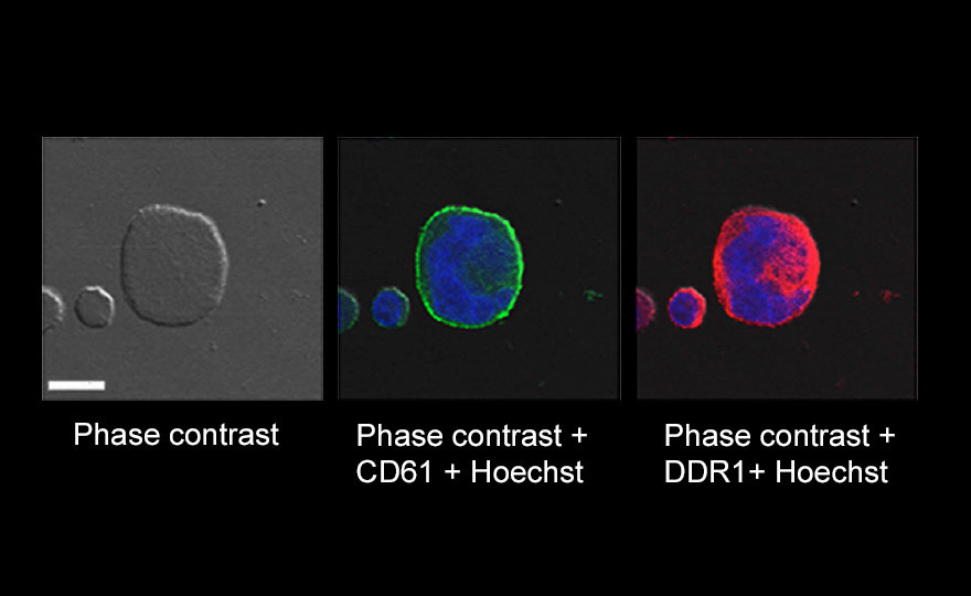 DDR1 expression by megakaryocyte