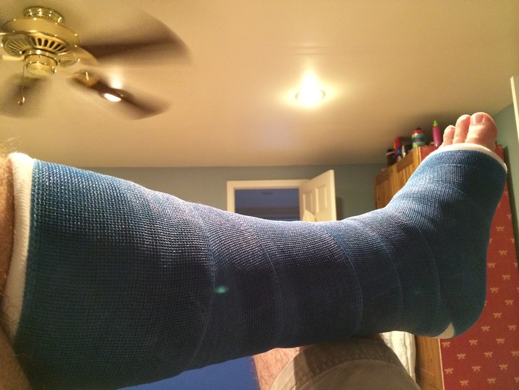 Only thing I could say about this cast is that I liked the color.