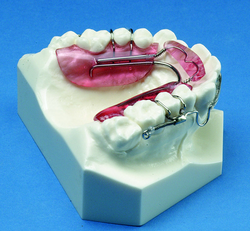 inman aligner orthodontic retainer