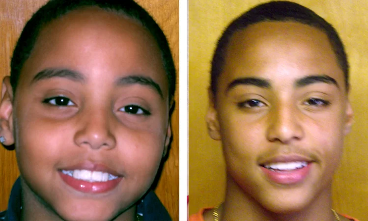 bronx braces patient