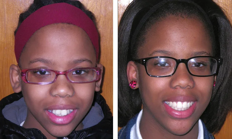 rego park orthodontist patient