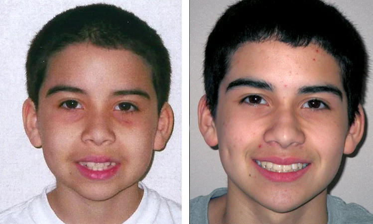 norwood orthodontist patient