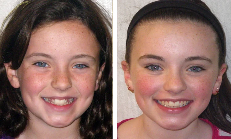 forest hills orthodontist