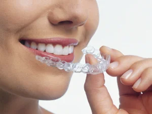 wideinvisalign.jpg