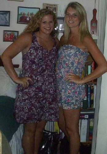 Sunburned sisters!