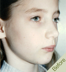 Orthodontic_C1_before.jpg