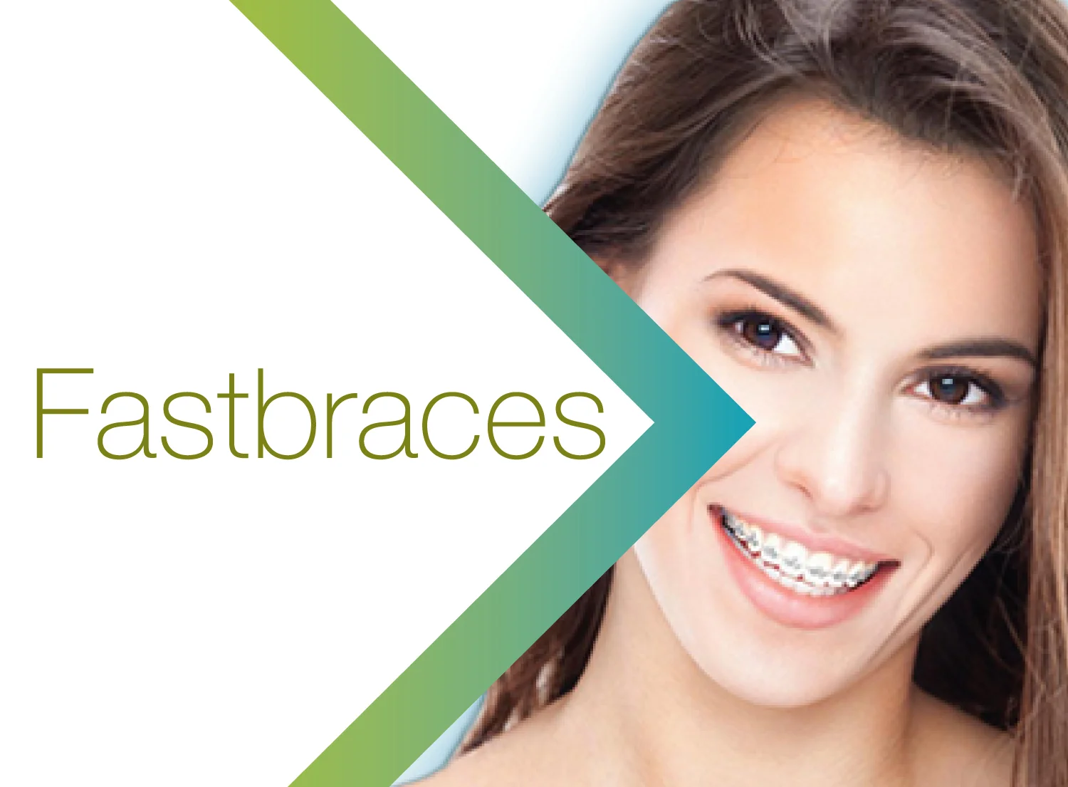 Glendowie Dental_Services_Fastbraces.jpg