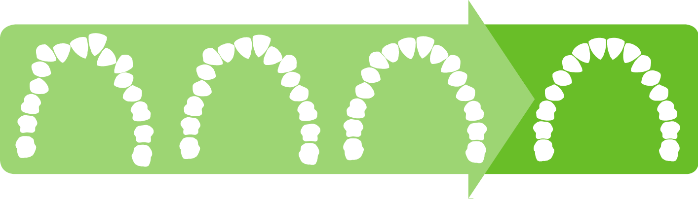 Tooth-Movement-v1@2x.png