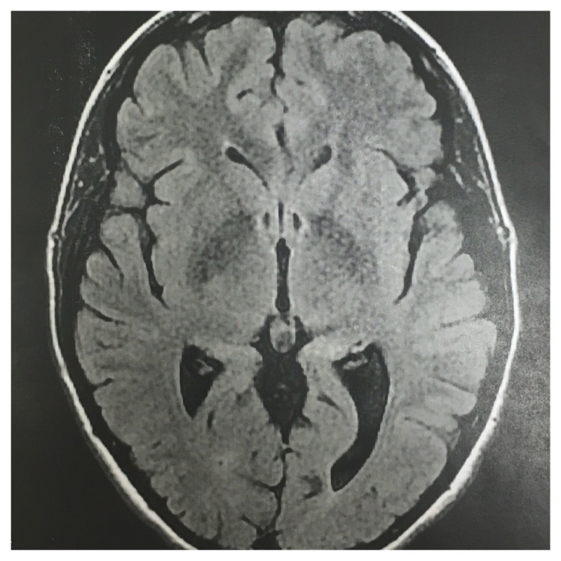 My brain for your viewing pleasure.
