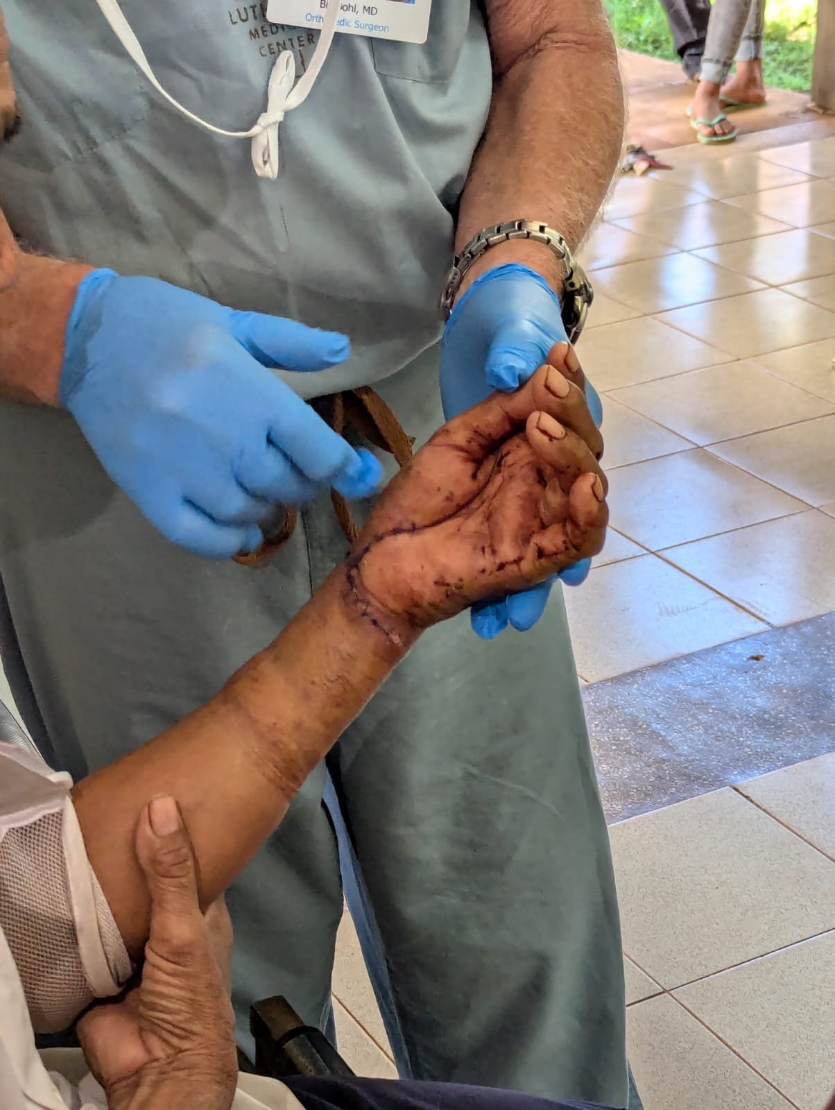 Hand Surgery post op (1).jpg