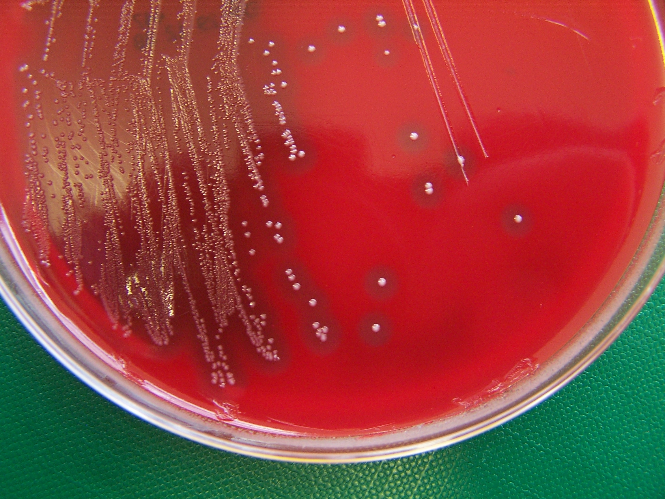 S. zooepidemicus colonies grown on a blood agar culture plate