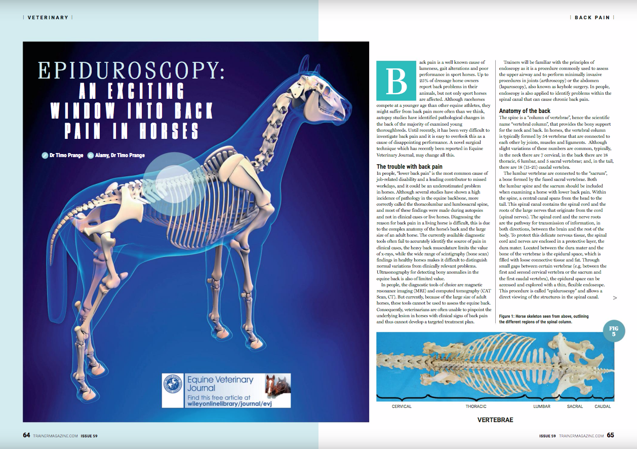 Back pain is a well known cause of lameness, gait alterations and poor performance in sport horses. Up to 25% of dressage horse owners report back problems in their animals, but not only sport horses are affected. Although racehorses compete at a younger age than other equine athletes, they might suffer from back pain more often than we think, autopsy studies have identified pathological changes in the back of the majority of examined young thoroughbreds. Until recently, it has been very difficult to investigate back pain and it is easy to overlook this as a cause of disappointing performance. A novel surgical technique which has recently been reported in Equine Veterinary Journal, may change all this. an adult racehorse of average size, the complete sacral, lumbar and a small part of the thoracic spinal canal can be reached with a 60 cm endoscope. How can epiduroscopy help veterinarians to find the source of pain in a horse with back problems? While the spinal cord sends and receives signals directly from the brain, the spinal nerves are the communication pathway between the spinal cord and the body. Spinal nerves are, among other things, responsible for the movements of the muscles in the back and legs and for sending information about pain in the back and legs back to the brain. Injury to a spinal nerve can result in dysfunction of muscles or in pain. Fortunately, the spinal nerve roots are well protected from injury, first by the surrounding bony vertebrae and, after leaving the spinal canal, by a thick muscle layer. However, the nerve can be injured at the point where it exits the spinal canal. The spinal nerves exit the canal through the openings between two adjacent vertebrae. The opening is called the intervertebral foramina. Each opening is in close proximity to the facet joints that connect the vertebrae. Inflammation of these joints (facet joint arthritis) causes back pain and results in irregular growth of bone around the arthritic joint. While severe bony changes can be picked up on radiographs, subtle changes can easily be missed. Unfortunately, even relatively small bony growths can impinge on the passing nerve and cause irritation and inflammation. Nerve root impingement is a recognized cause of lower back and leg pain in people and now that we have epiduroscopy available for horses, it will be possible to identify the prevalence and importance of this condition in equine athletes. This will be especially interesting for young racehorses, where facet joint arthritis can be found in the thoracolumbar spine of up to 97% of cases that undergo autopsy but currently there is no information about the effects of this arthritis on passing spinal nerves. << Fig 7 near here>> Will epiduroscopy lead to better treatments? Epiduroscopy can not only identify an inflamed nerve root, it can also be used to treat the inflammation through targeted injections of steroids via the working channel of the endoscope. There is a lot more work to do before this approach becomes commonplace for back pain. However, at North Carolina State University, the approach has used epiduroscopy to diagnose and successfully treat nerve root inflammation in the neck of an adult horse with chronic forelimb lameness. With help of the recently described lumbosacral epiduroscopy, it is now also possible to introduce this approach for therapy for inflammation in the spinal nerves located in the lower back. At North Carolina State College of Veterinary Medicine, we are currently developing a protocol to identify horses with back pain and unknown causes of hindlimb lameness that are suitable candidates for lumbosacral epiduroscopy. The findings of these examinations should shed more light on unknown or underestimated causes of back and leg pain in horses. Back pain is a common and well-recognised problem in sport horses and may be an underestimated reason for poor performance in young racehorses. Autopsy findings suggest that especially young thoroughbreds frequently suffer from lesions in the muscles and joints of the lower back, but diagnosing these abnormalities is difficult in living horses. Some cases << EVJ logo near here>> The trouble with back pain In people, “lower back pain” is the most common cause of job-related disability and a leading contributor to missed workdays, and it could be an underestimated problem in horses. Although several studies have shown a high incidence of pathology in the equine backbone, more correctly called the thoracolumbar and lumbosacral spine, and most of these findings were made during autopsies and not in clinical cases or live horses. Diagnosing the reason for back pain in a living horse is difficult, this is due to the complex anatomy of the horse’s back and the large size of an adult horse. The currently available diagnostic tools often fail to accurately identify the source of pain in clinical cases, the heavy back musculature limits the value of x-rays, while the wide range of scintigraphy (bone scan) findings in healthy horses makes it difficult to distinguish normal variations from clinically relevant problems. Ultrasonography for detecting bony anomalies in the equine back is also of limited value. In people, the diagnostic tools of choice are magnetic resonance imaging (MRI) and computed tomography (CAT Scan, CT). But currently, because of the large size of adult horses, these tools cannot be used to assess the equine back. Consequently, veterinarians are often unable to pinpoint the underlying lesion in horses with clinical signs of back pain and thus cannot develop a targeted treatment plan. Trainers will be familiar with the principles of endoscopy as it is a procedure commonly used to assess the upper airway and to perform minimally invasive procedures in joints (arthroscopy) or the abdomen (laparoscopy), also known as keyhole surgery. In people, endoscopy is also applied to identify problems within the spinal canal that can cause chronic back pain. Anatomy of the back The spine is a “column of vertebrae”, hence the scientific name “vertebral column”, that provides the bony support for the neck and back. In horses, the vertebral column is typically formed by 54 vertebrae that are connected to each other by joints, muscles and ligaments. Although slight variations of these numbers are common, typically, in the neck there are 7 cervical, in the back there are 18 thoracic, 6 lumbar, and 5 sacral vertebrae; and, in the tail, there are 18 (15-21) caudal vertebra. <<Figure 1 near here>> The lumbar vertebrae are connected to the “sacrum”, a bone formed by the fused sacral vertebrae. Both the lumbar spine and the sacrum should be included when examining a horse with lower back pain. Within the spine, a central canal spans from the head to the tail. This spinal canal contains the spinal cord and the roots of the large nerves that originate from the cord (spinal nerves). The spinal cord and the nerve roots are the pathway for transmission of information, in both directions, between the brain and the rest of the body. To protect this delicate nervous tissue, the spinal cord and nerves are enclosed in a protective layer, the dura mater. Located between the dura mater and the bone of the vertebrae is the epidural space, which is filled with loose connective tissue and fat. Through small gaps between certain vertebrae (e.g. between the first and second cervical vertebra or the sacrum and the first caudal vertebra), the epidural space can be accessed and explored with a thin, flexible endoscope. This procedure is called “epiduroscopy” and allows a direct viewing of the structures in the spinal canal. Epiduroscopy Epiduroscopy is used in people to, among other things, diagnose injury and compression of the spinal cord and the spinal nerves. In horses, the cervical spinal canal, located in the neck, and the lumbosacral spinal canal, situated in the lower back, can be examined with epiduroscopy. While anaesthesia is required to examine the neck, lumbosacral epiduroscopy is done in standing, sedated horses. A specialised endoscope set-up is required and since sterility is critical, epiduroscopy should only be performed in referral hospitals. The instrument has to be long enough to allow examination of the complete lumbosacral spinal canal and thin enough to fit into this narrow space. Ideally, the endoscope is at least 60 cm long but no thicker than 4 mm <<Figure 2 near here>>. The epidural space is entered through a small gap between two vertebrae, just above the base of the tail (Figure 3). The endoscope is then slowly inserted while the surgeon injects small amounts of a sterile saline solution through its working channel (Figure 4). This is necessary to push the epidural fat and connective tissue gently out of the way and allow viewing of the structures of interest, as shown in (Figures 5 and 6): the spinal cord and spinal nerves (enveloped by the dura mater), blood vessels and the inside of the surrounding vertebrae. In can be diagnosed with the currently available diagnostic tools, including a thorough clinical examination, radiographs, ultrasound and bone scan. In cases where these methods have been exhausted and failed to provide a diagnosis, epiduroscopy might provide the missing piece of information. Legends Figure 1: Horse skeleton seen from above, outlining the different regions of the spinal column. Figure 2: Tip of a flexible videoendoscope that is suitable for lumbosacral epiduroscopy. The instrument is 60 cm long and has an outer diameter of 3.8 mm (Olympus BF-C 160). Figure 3: This horse has been draped for lumbosacral epiduroscopy. The site where the endoscope will be inserted is left uncovered and has been prepared for aseptic surgery. Figure 4: With his right hand, the surgeon slowly inserts the endoscope through a white plastic sheath into the epidural space. With his left hand, he controls the moveable tip of the endoscope. In the background, the monitor depicting the endoscopy image can be seen (out of focus). Figure 5: Prior to injection of sterile saline through the working channel of the endoscope, the ability to see the different anatomical structures in the epidural space is very limited. At the bottom of the image, the dura mater that covers the spinal cord can be seen, while the epidural fat (on top of the dura mater) prohibits viewing of other structures. Figure 6: Following careful injection of sterile saline solution, the examination becomes more rewarding. A spinal nerve root (*) can be seen emerging from the spinal cord (covered by dura mater) and cross the epidural space. Epidural fat can be seen above (x). Figure 7: Pipe cleaners have been inserted into the intervertebral foramina, the opening between adjacent vertebrae through which spinal nerves exit the spinal canal. Note the close proximity of the facet joints (arrowheads). Video 1: Preparation and insertion of the endoscopy in a sedated horse. If you would prefer to include a link to this video currently it can be found at: http://onlinelibrary.wiley.com/store/10.1111/evj.12591/asset/supinfo/evj12591-sup-0001-Item1.mp4?v=1&s=735ecdd6a1606af5023c32d0406c01ef5e6f2445 Video 2: Lumbosacral epiduroscopy in a healthy horse. If you would prefer to include a link to this video currently it can be found at: http://onlinelibrary.wiley.com/store/10.1111/evj.12470/asset/supinfo/evj12470-sup-0002-MovieS1.mov?v=1&s=188211909de8842a9c434f5d202e2e76d53690