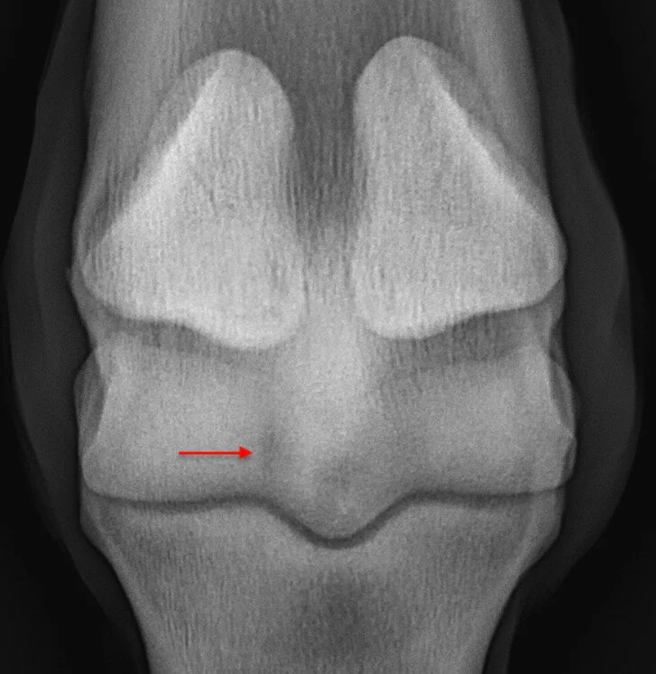 Minimizing serious fractures of the racehorse fetlock Trainer