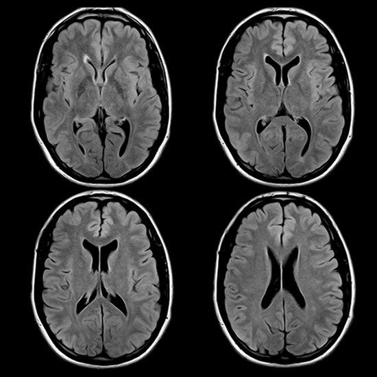 CT vs MRI | What's the difference? MRI | Largest Open Bore MRI Center