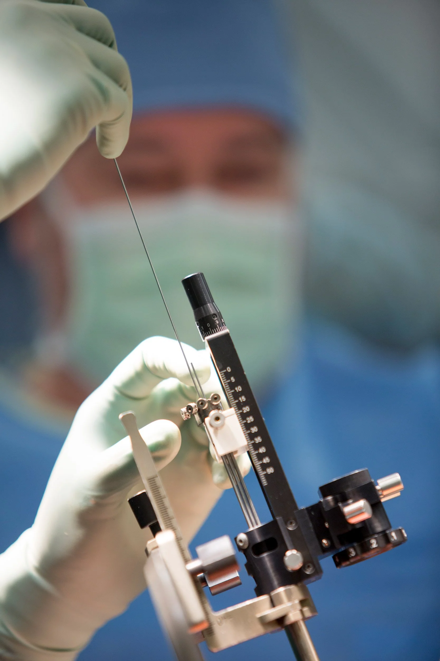 Houston_Methodist_Deep Brain Stimulation