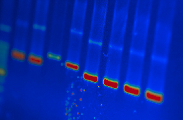 Photograph by University of Michigan DNA Lab