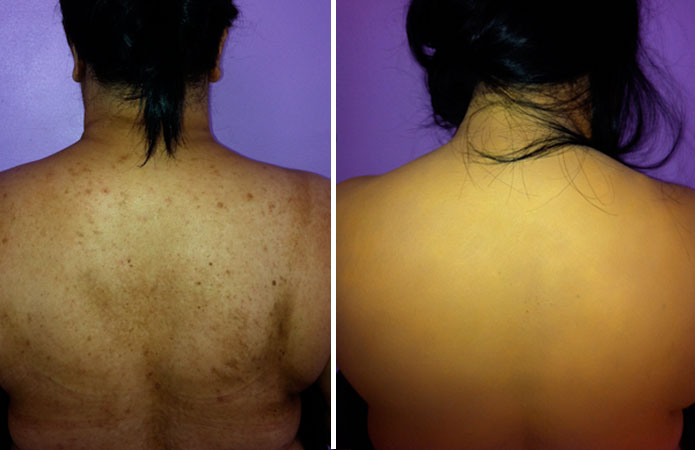 maria_lee_makeup_airbrush_camouflage_back.jpg
