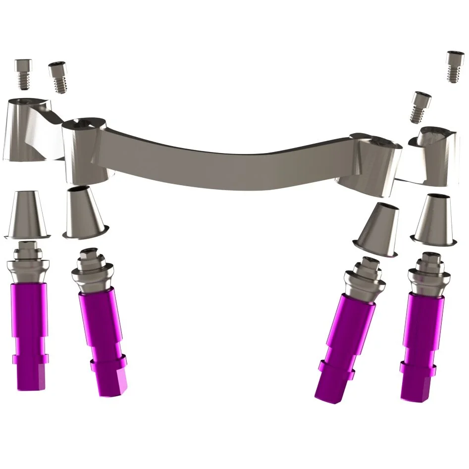 Steg auf Multi-Unit mit Titanbasen.