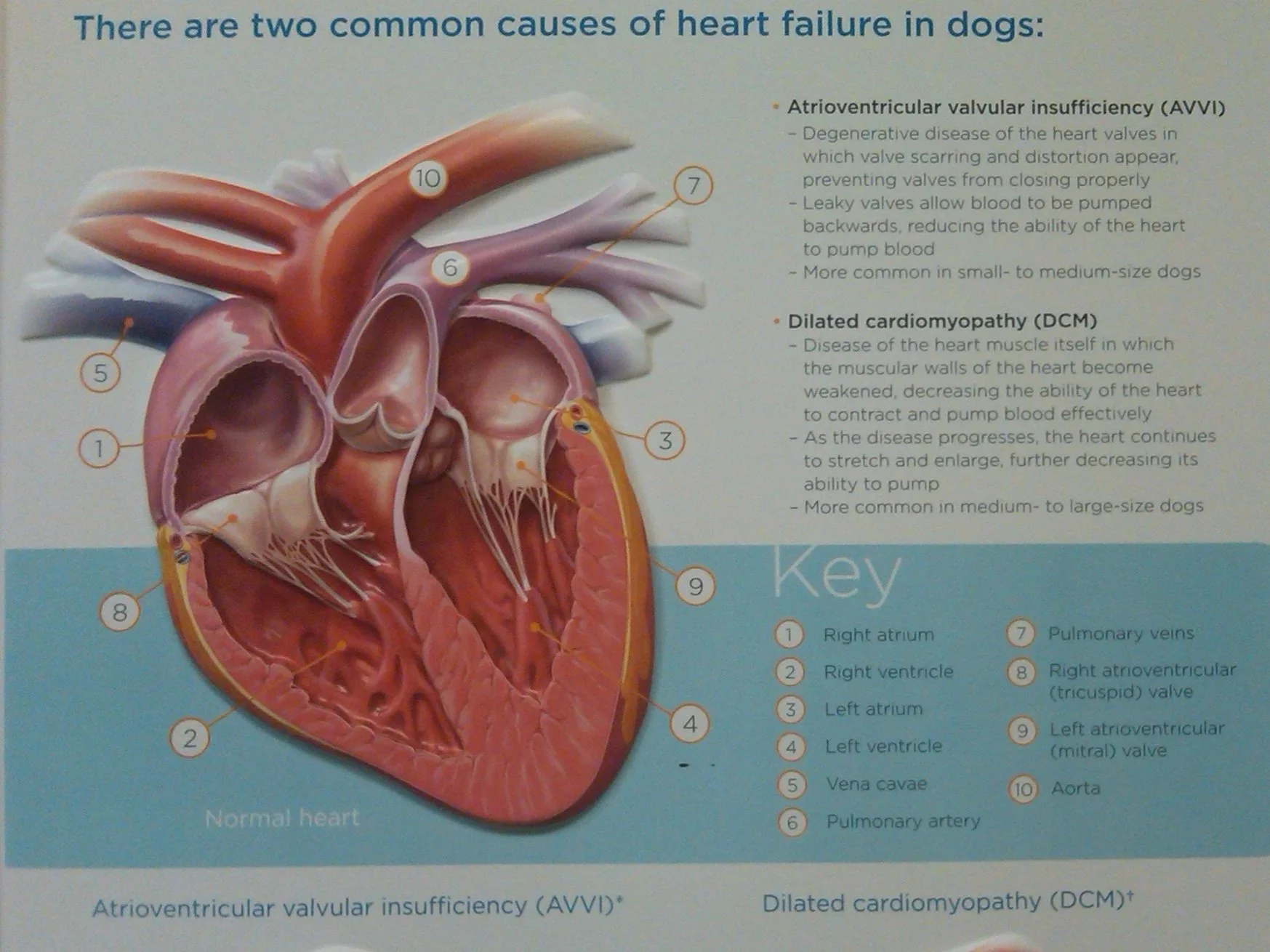 Cardiovascular (Heart) Disease