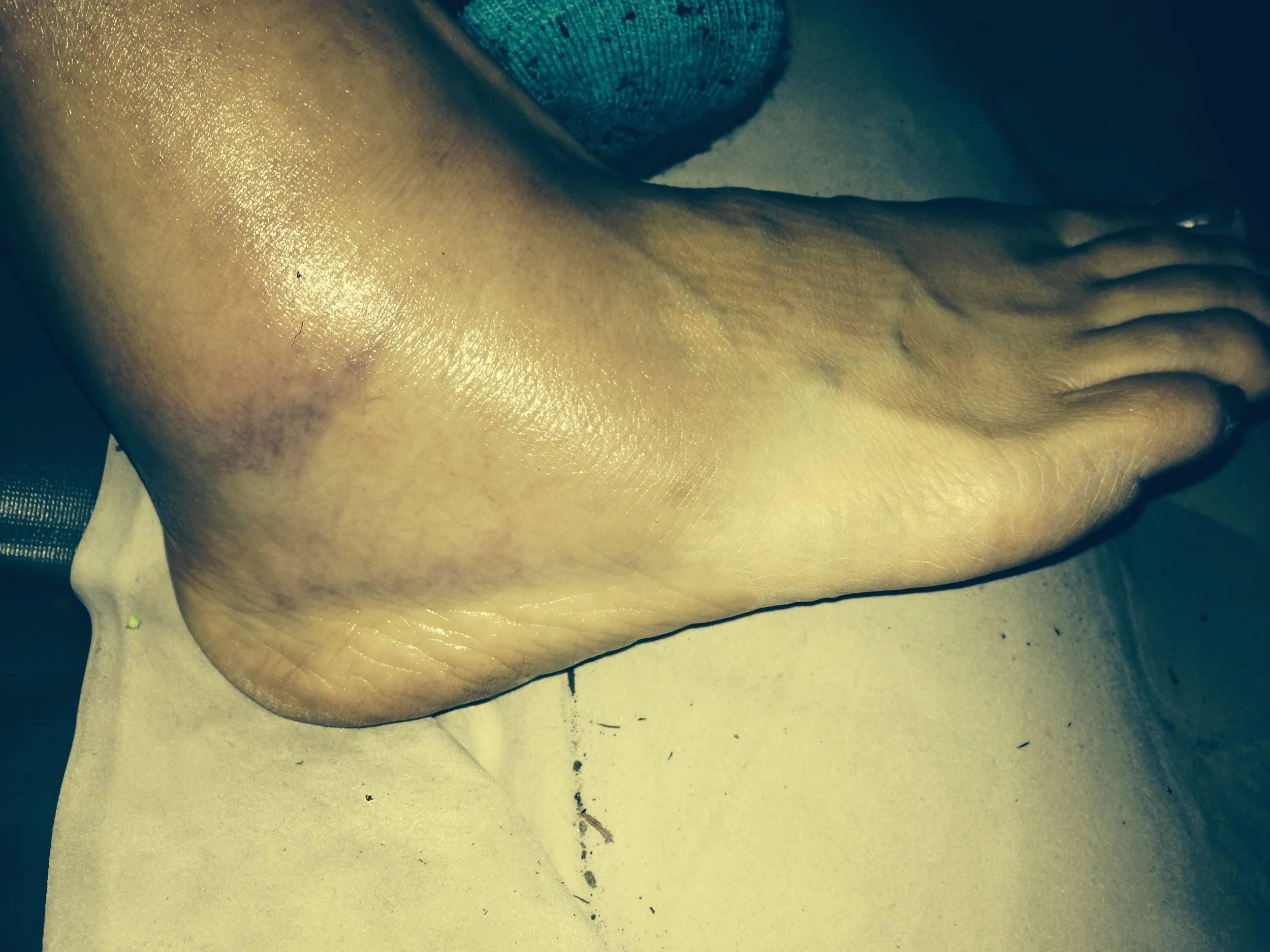 Doreen's lovely ankle. There is an ankle bone somewhere--there is!