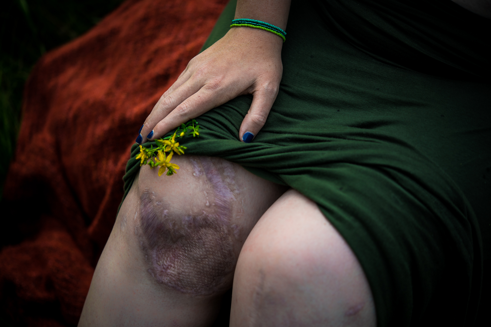 Wounds That Heal