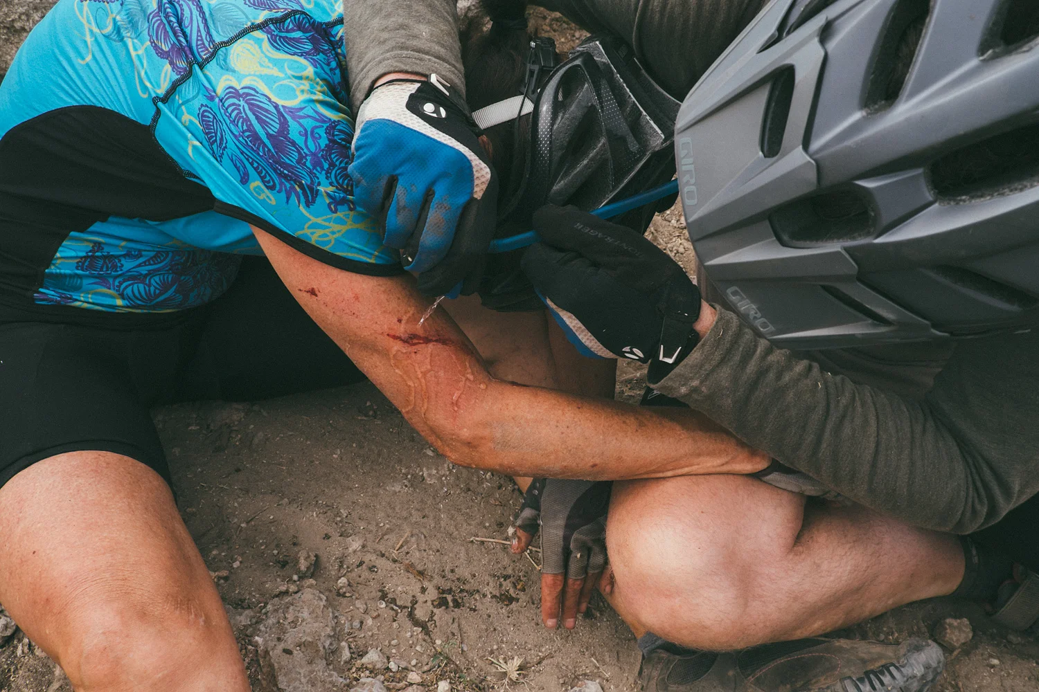 ^ Patty took a gnarly spill. Myself being a male, I was not shown the full aftermath of what the fall did to her butt/thigh region, but other females reported an ungodly large blend of blacks, blues, and purples in a bruise the size of a small child. 