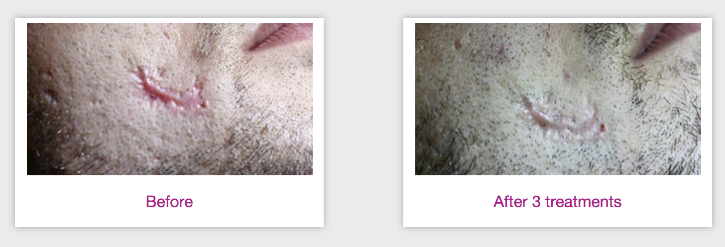 Photos courtesy of Alain Braun, MD